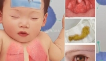 “毒王”来袭！反复高热，近期多人中招，带娃玩水要警惕