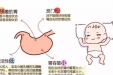 健康科普| 婴幼儿照护篇之喂养意外