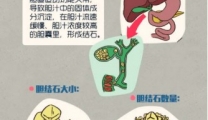 胆囊结石全解析：从成因到预防的全方位指南