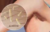 温江帅哥胳肢窝“长霉”了，这件事做多做少都“翻车”