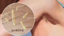 温江帅哥胳肢窝“长霉”了，这件事做多做少都“翻车”