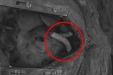 24岁打工人感觉身体被掏空，医生：换人工血管