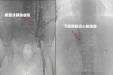 温江大姐双腿变黑，擦伤多月无法愈合，竟是这怪病找上了她