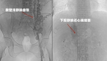 温江大姐双腿变黑，擦伤多月无法愈合，竟是这怪病找上了她